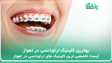 بهترین کلینیک ارتودنسی در اهواز