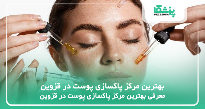 بهترین مرکز پاکسازی پوست در قزوین