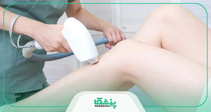نکات مراقبتی قبل از لیزر