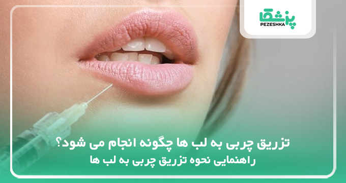 تزریق چربی به لب ها چگونه انجام می شود؟