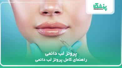 پروتز لب دائمی