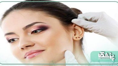 بهترین جراح زیبایی گوش در قزوین