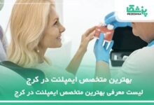 بهترین متخصص ایمپلنت در کرج