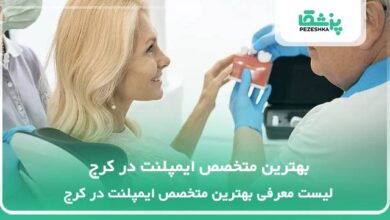 بهترین متخصص ایمپلنت در کرج