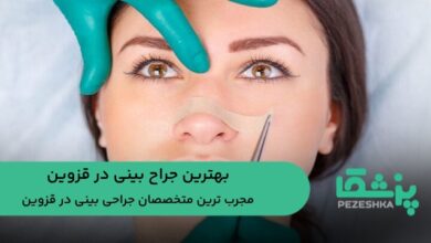 بهترین جراح بینی در قزوین