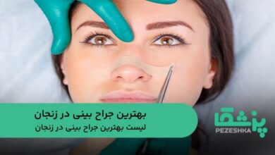 بهترین جراح بینی در زنجان