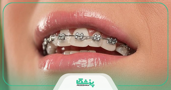 ویژگی های بهترین دکتر ارتودنسی در قزوین