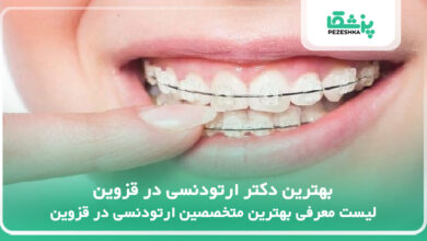 بهترین دکتر ارتودنسی در قزوین