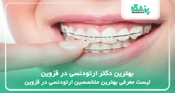 بهترین دکتر ارتودنسی در قزوین
