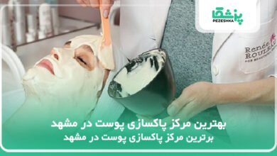 بهترین مرکز پاکسازی پوست در مشهد