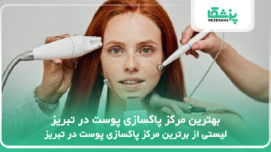 بهترین مرکز پاکسازی پوست در تبریز