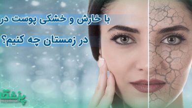 با خارش و خشکی پوست در زمستان چه کنیم؟