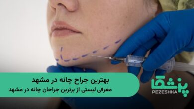 بهترین جراح چانه در مشهد