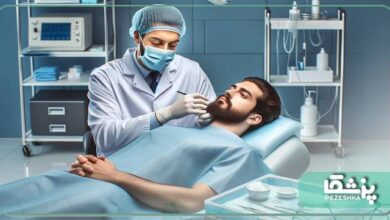هزینه کاشت ریش