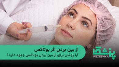 از بین بردن اثر بوتاکس
