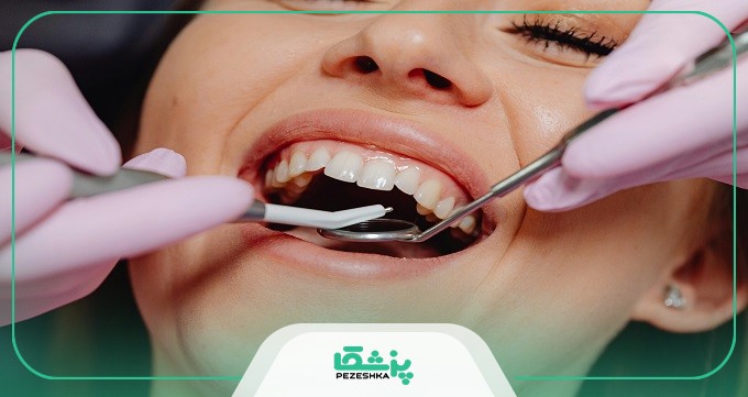 بهترین زمان برای مراجعه به دندانپزشک