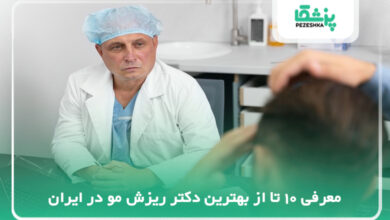بهترین دکتر ریزش مو در ایران