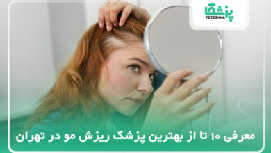 بهترین پزشک ریزش مو در تهران