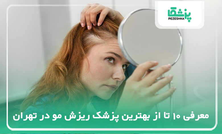بهترین پزشک ریزش مو در تهران