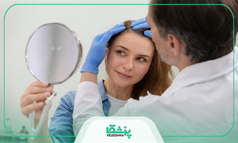 روش های تشخیص ریزش مو