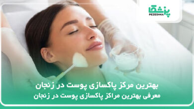 بهترین مرکز پاکسازی پوست در زنجان