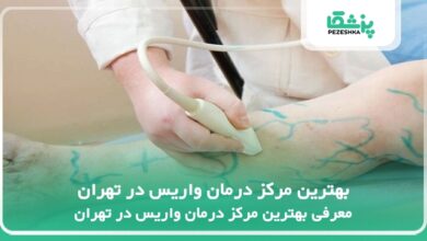 بهترین مرکز درمان واریس در تهران
