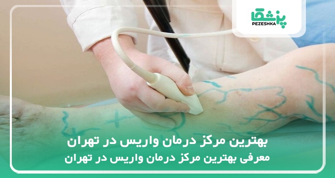 بهترین مرکز درمان واریس در تهران