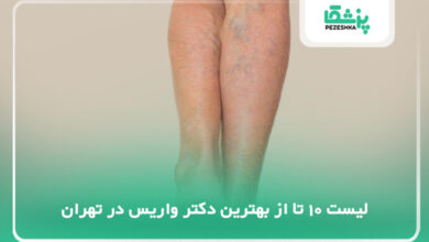 بهترین دکتر واریس در تهران