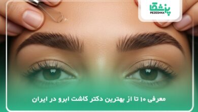 بهترین دکتر کاشت ابرو در ایران