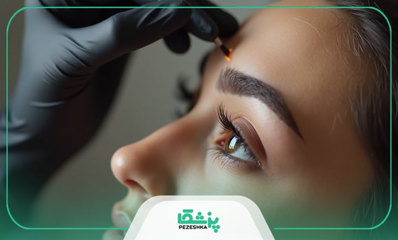 چرا انتخاب بهترین دکتر کاشت ابرو در ایران اهمیت دارد؟