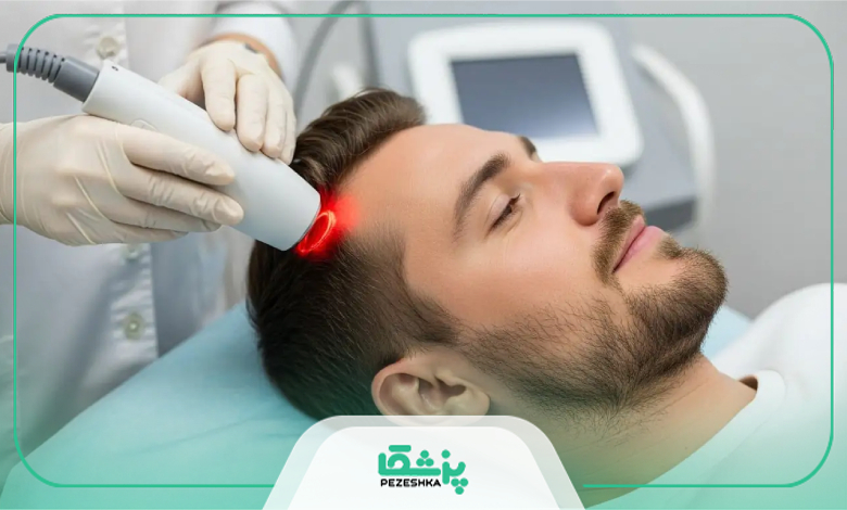 چه زمانی برای درمان ریزش مو به پزشک مراجعه کنیم؟