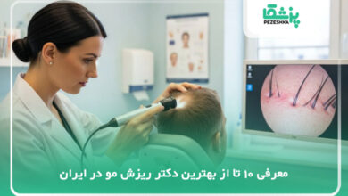 بهترین دکتر ریزش مو در ایران