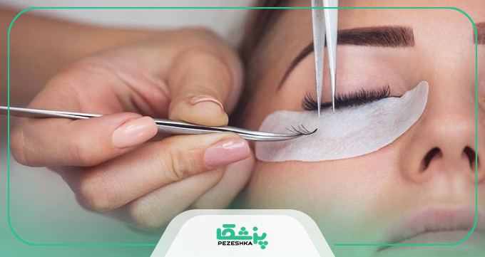 کاشت مژه موقت برای چه کسانی مناسب نیست؟