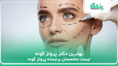 بهترین دکتر پروتز گونه