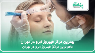 بهترین مرکز فیبروز ابرو در تهران