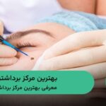 10 تا از بهترین مرکز برداشتن خال ⚡️【سال1404】❤️