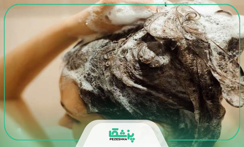 نکات مهم هنگام خرید شامپو موی سر