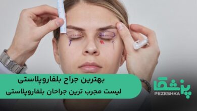 بهترین جراح بلفاروپلاستی