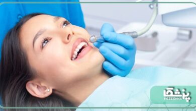 بهترین دندانپزشکی زیبایی و ترمیمی در اصفهان