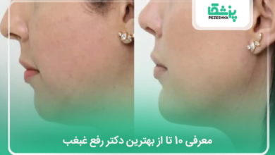 بهترین دکتر رفع غبغب