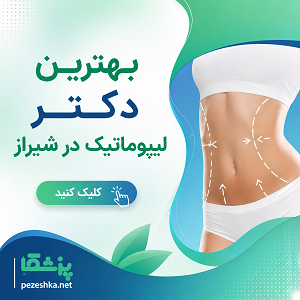بهترین دکتر لیپوماتیک در شیراز