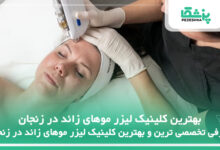 بهترین کلینیک لیزر موهای زائد در زنجان