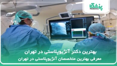 بهترین دکتر آنژیوپلاستی در تهران