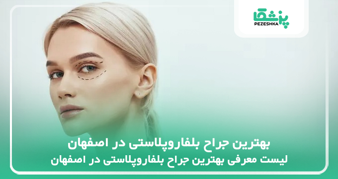 بهترین جراح بلفاروپلاستی در اصفهان