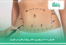 بهترین جراح پیکرتراشی در شیراز