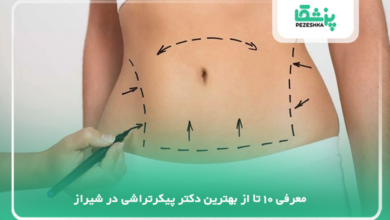 بهترین جراح پیکرتراشی در شیراز