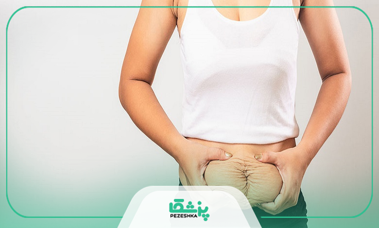 عوارض و خطرات احتمالی پیکرتراشی