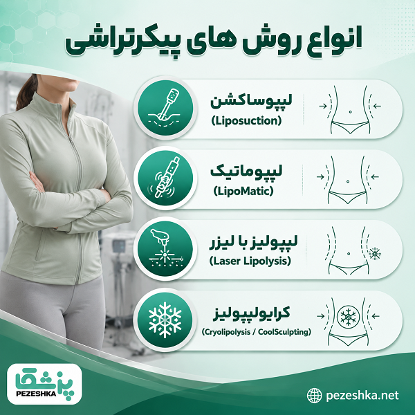 انواع روش های پیکرتراشی