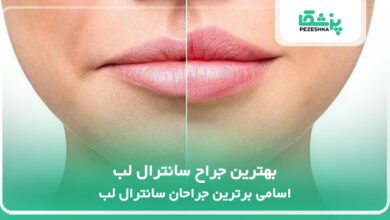 بهترین جراح سانترال لب