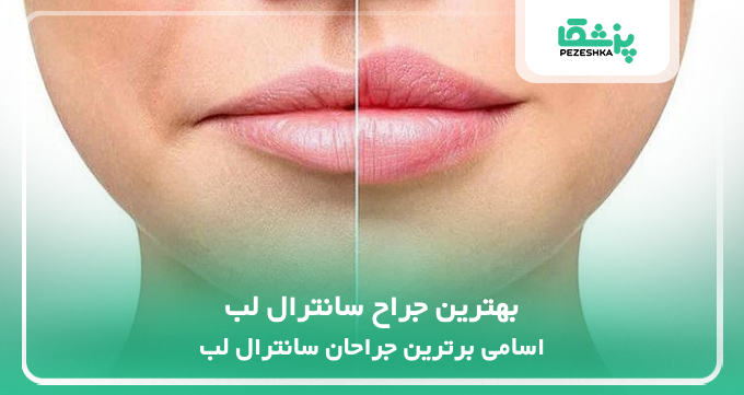 بهترین جراح سانترال لب